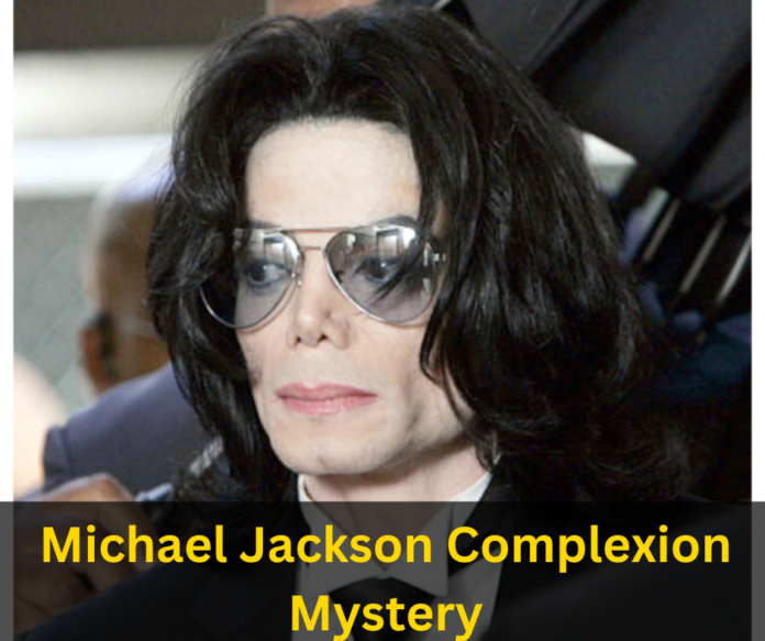 How Did Michael Jackson Turn White? Unfolded Great Mystique