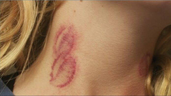 how to give someone a hickey